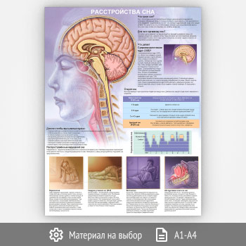 Плакат «Расстройства сна» (ЗОЖ-30, 1 лист)